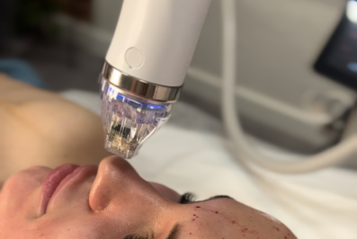 Jakie zabiegi polecamy dla skóry dojrzałej?