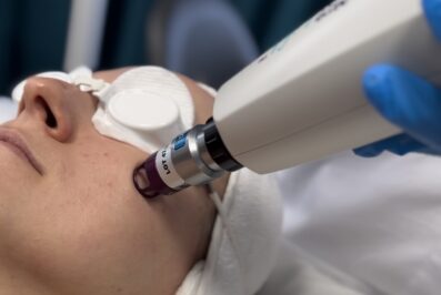 Laserowy lifting ✨